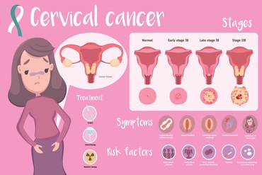 CERVICAL_CANCER_EVERYTHING_YOU_NEED_TO_BE_AWARE_ABOUT_blog